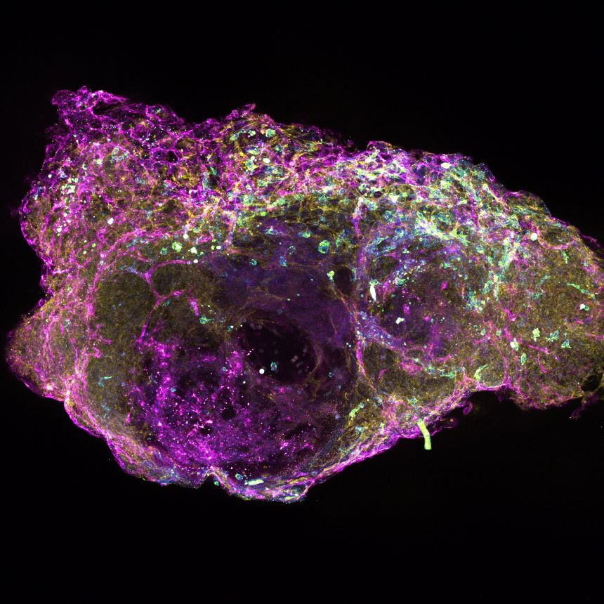 Cross section of a mini bone marrow organoids