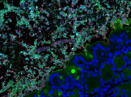 A microscopy image Bacteria in the mammalian gut. The bacteria are the small green, red, blue cells, which are sitting above the gut wall (host cell nuclei are the blue circles surrounded by green mucus. 