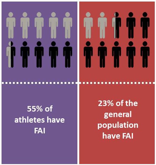 Infographic showing that 55% of athletes have FAI versus 23% of the general population