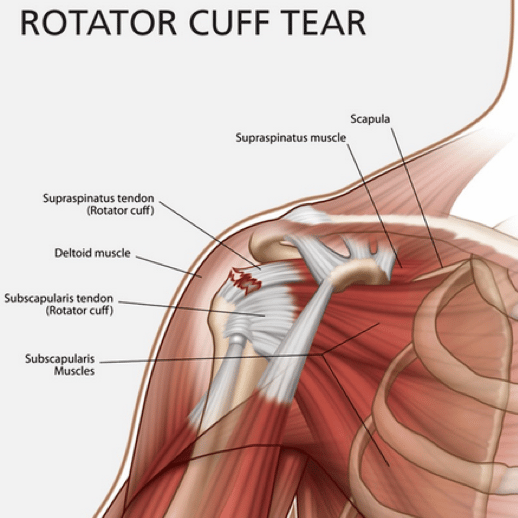 Illustration showing labelled shoulder anatomy