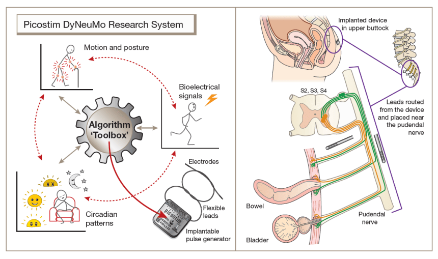 Diagram of the Picostim DyNeuMo research system toolbox 