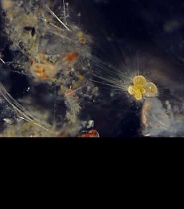 A light microscope image of a planktonic foraminifera surrounded by thins strands of its cytoplasm that extend into the surrounding environment. 