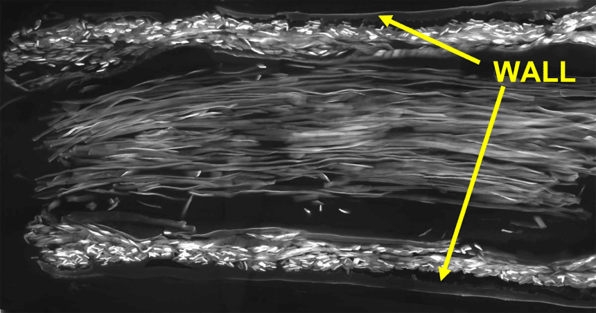 Scanning electron microscope image of a longitudinal section through a silk conduit containing nerve-guiding luminal silk fibres. Image credit: Newrotex Ltd