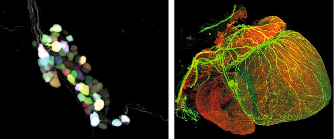 Nervous system in the heart.jpg