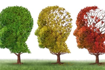 Aging brains depicted as trees