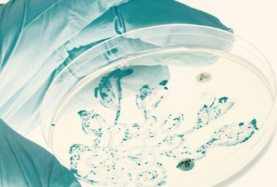 Bacteria on a Petri Dish