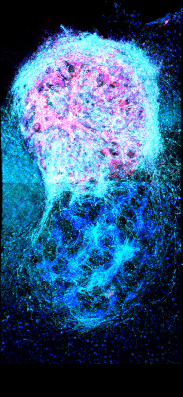 A mass of fluorescent cells with long projections.