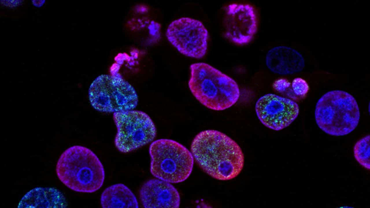 Colorectal cancer cells, with the nuclei stained blue. Created by Yves Pommier, Rozenn Josse, 2014. Image from the National Cancer Institute.