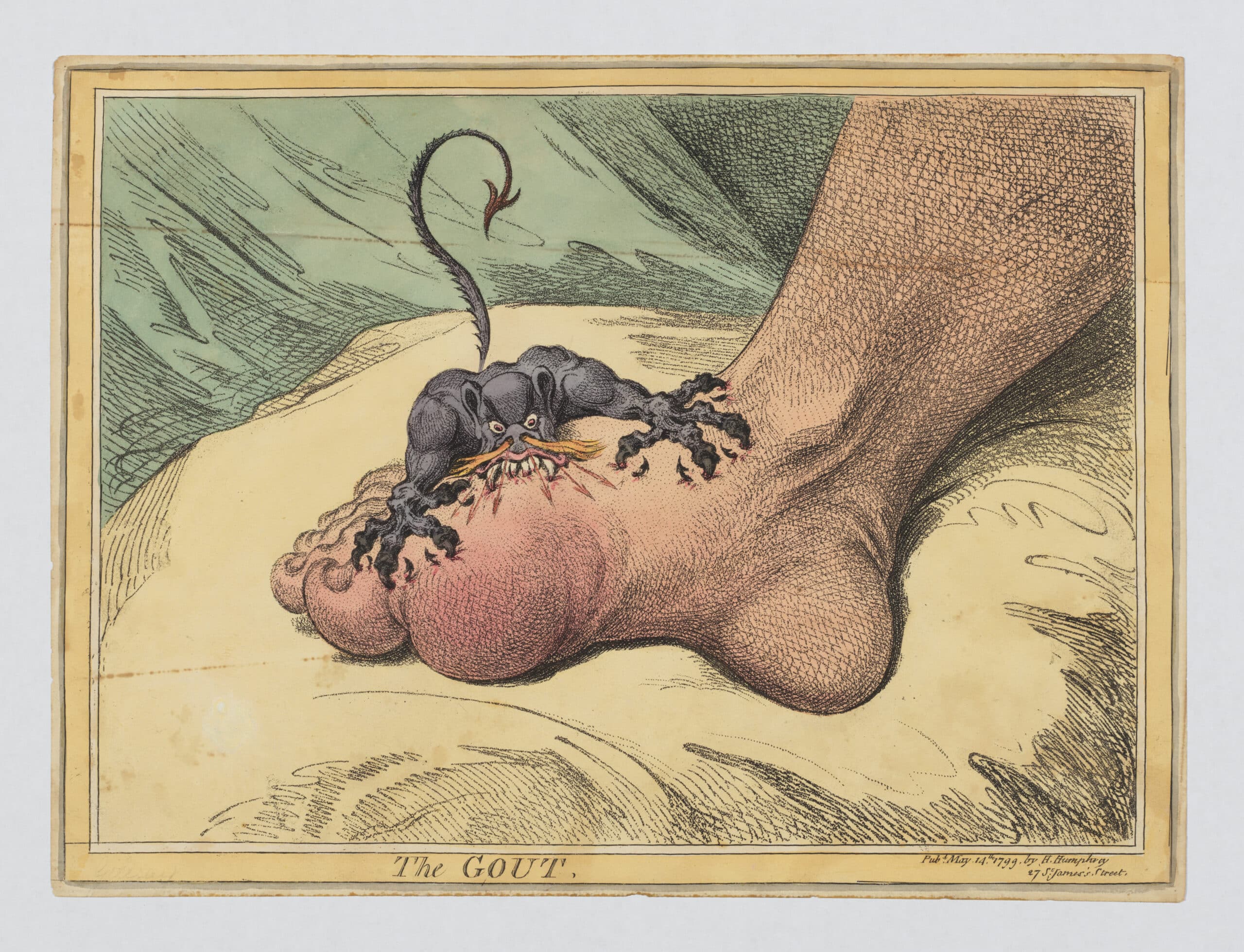 'The Gout', a Georgian caricature by James Gillray (1799).